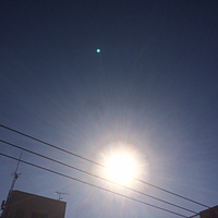 鍼灸予約　2月25日(土) 晴れのち曇り　最高気温10℃　(京都の鍼灸院　泰楽）サムネイル