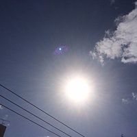 鍼灸予約　2月27日(月) 晴れ　最高気温10℃　(京都の鍼灸院　泰楽）サムネイル