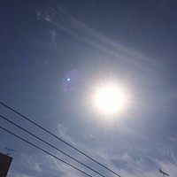 鍼灸予約　3月4日(土) 晴れ時々曇り　最高気温14℃　(京都の鍼灸院　泰楽）サムネイル