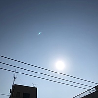 鍼灸予約 3月2日(土) 晴れのち曇り 最高気温15℃(京都の鍼灸院 泰楽)サムネイル