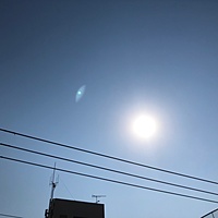 鍼灸予約 3月15日(金) 晴れのち雨 最高気温15℃(京都の鍼灸院 泰楽)サムネイル