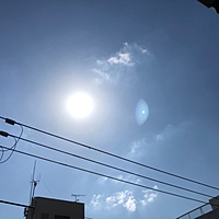 鍼灸予約 4月8日(月) 曇りのち晴れ 最高気温21℃(京都の鍼灸院 泰楽)サムネイル