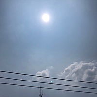 鍼灸予約 6月20日(木) 晴れのち曇り 最高気温31℃(京都の鍼灸院 泰楽)サムネイル