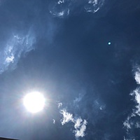 鍼灸予約 9月9日(月) 晴れのち曇り 最高気温36℃(京都の鍼灸院 泰楽)サムネイル