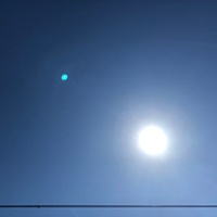 鍼灸予約 9月17日(火) 晴れのち曇り 最高気温31℃(京都の鍼灸院 泰楽)サムネイル